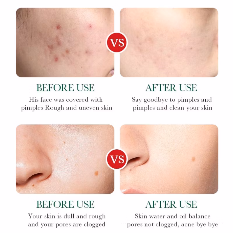 Salicylic Acid Pore-Refining Serum: Deep Hydration, Firming, and Brightening Formula - Image 8