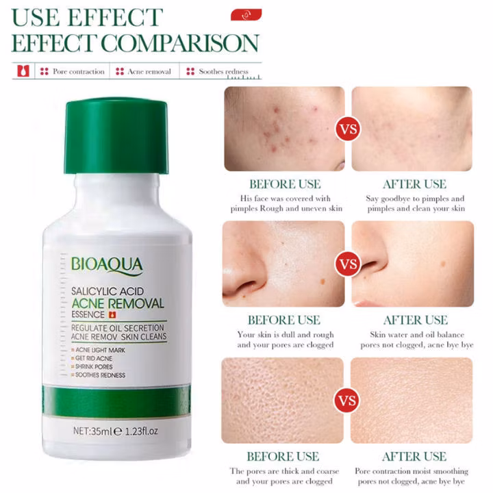 Salicylic Acid Pore-Refining Serum: Deep Hydration, Firming, and Brightening Formula - Image 5